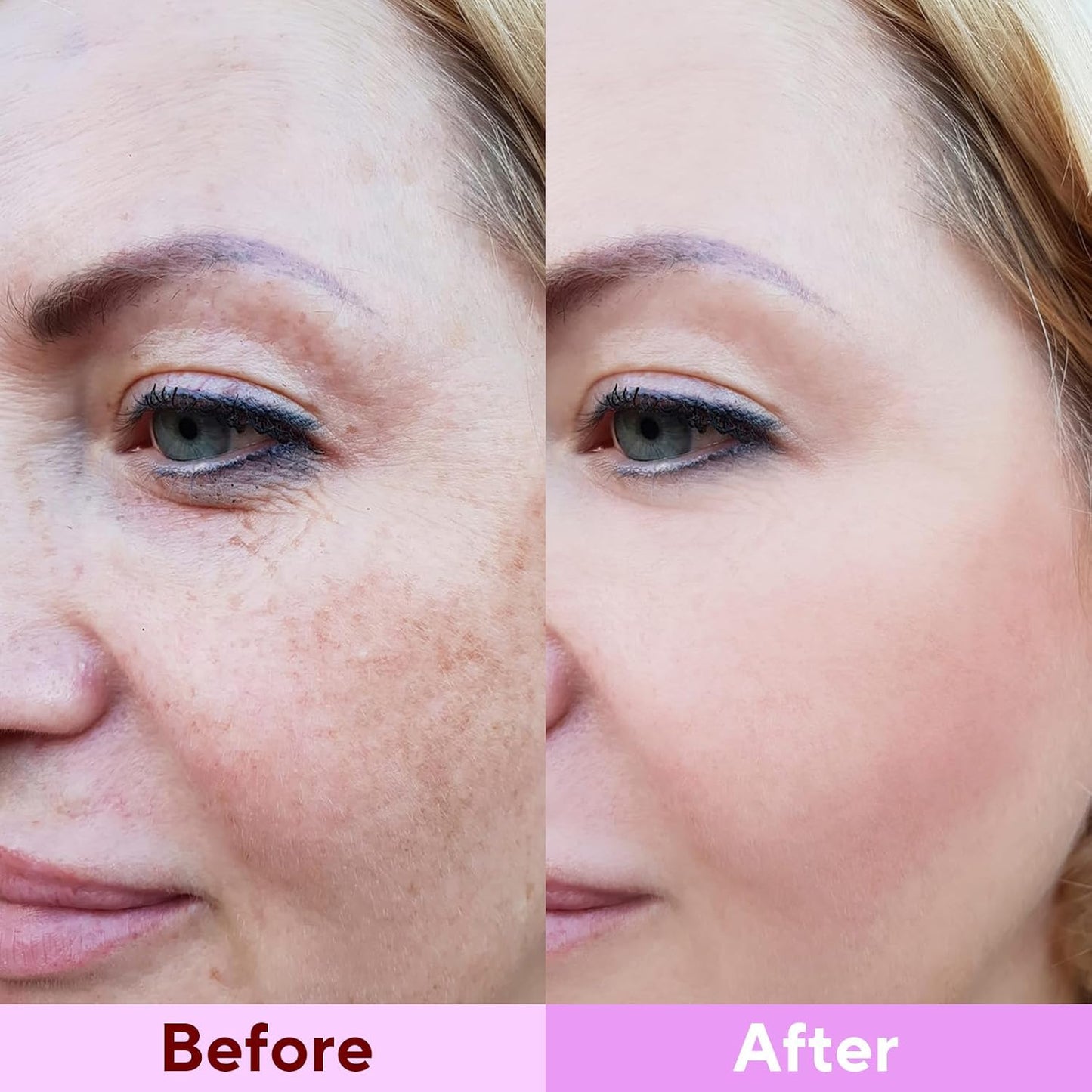 Collagen Placenta Mask - 10masks